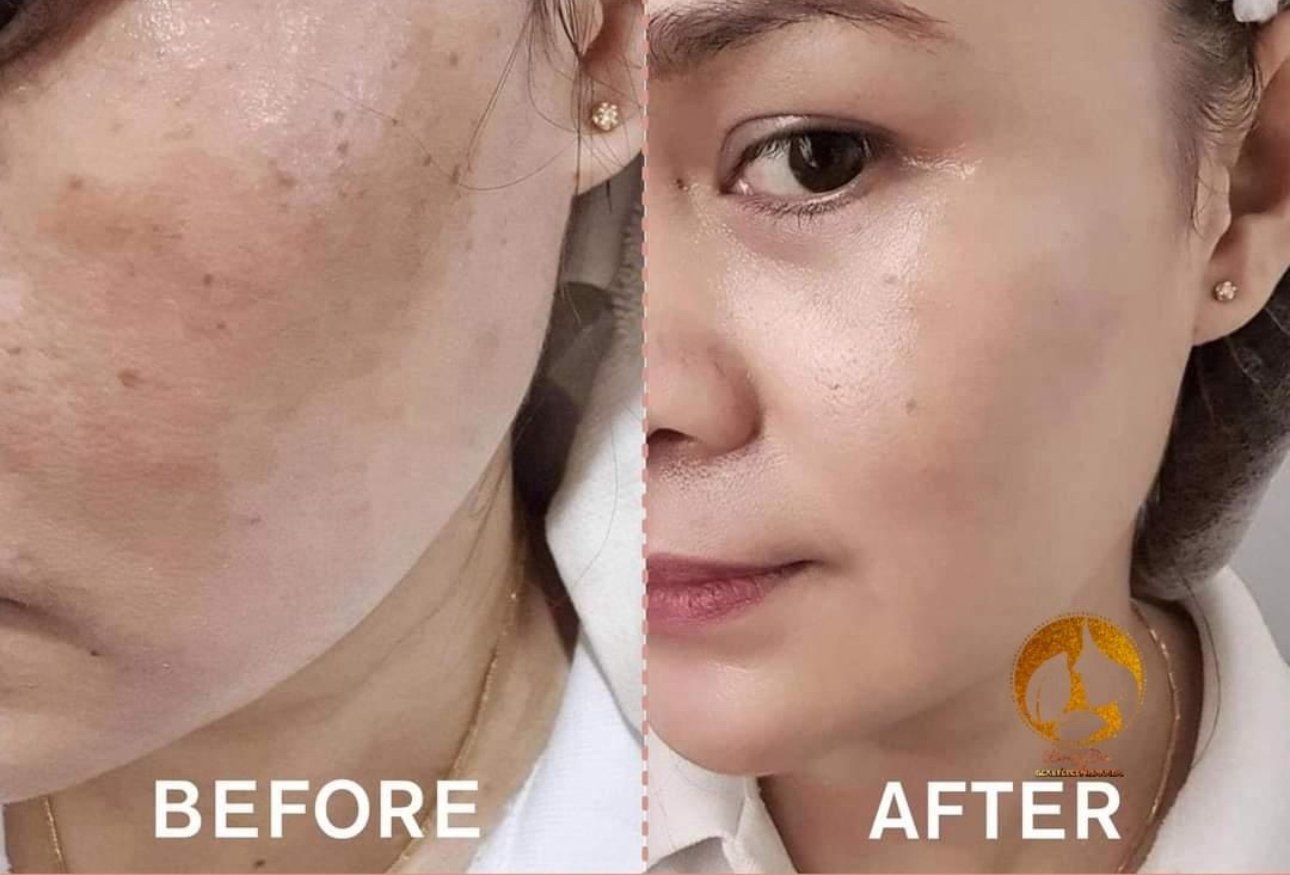 Beautederm Regular Set - 60ml Toner plus FREEBIES (Good for 2 months)