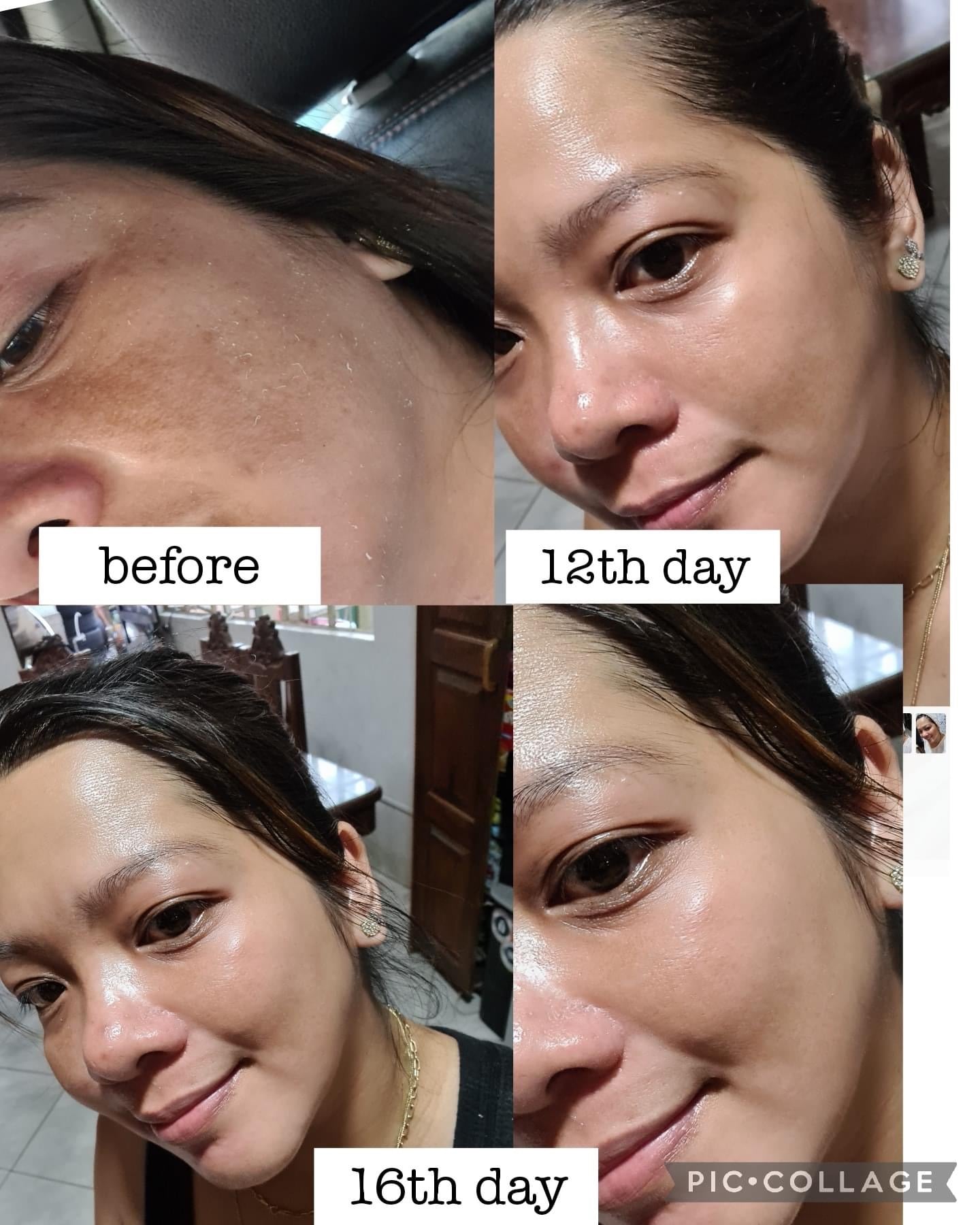 Complete Serum Set- Morning and Night Routine