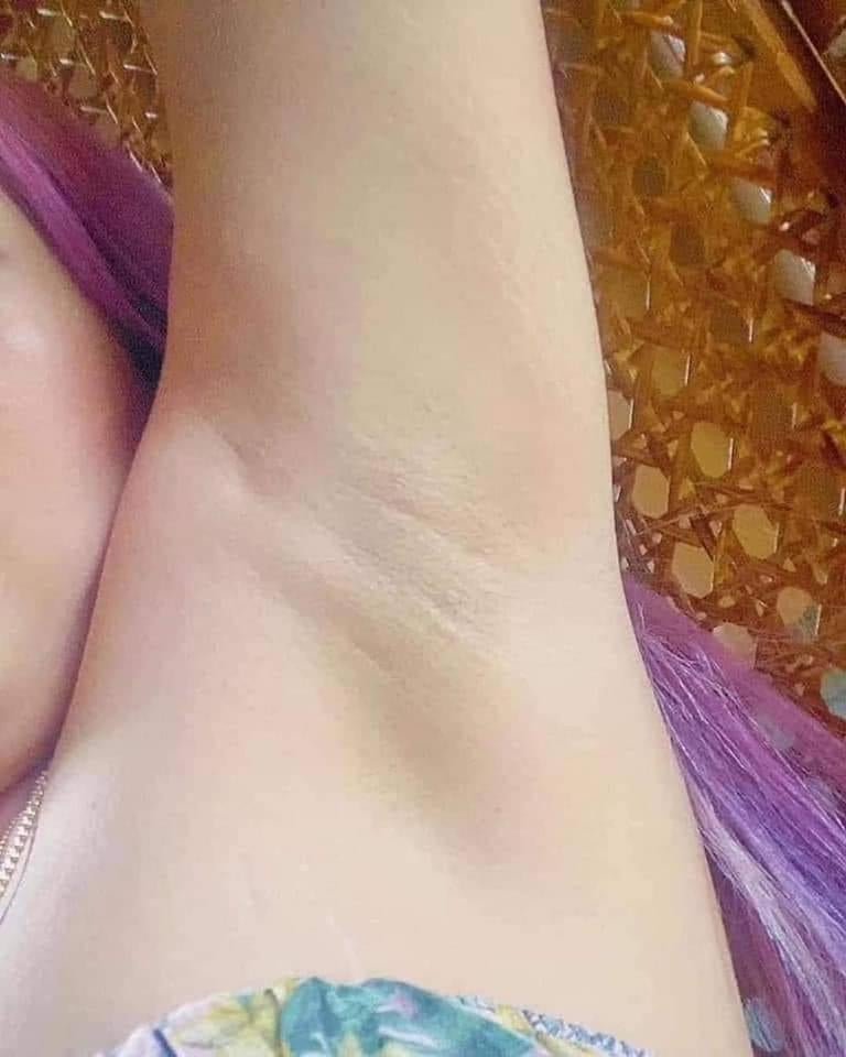 Underarm Whitening Set