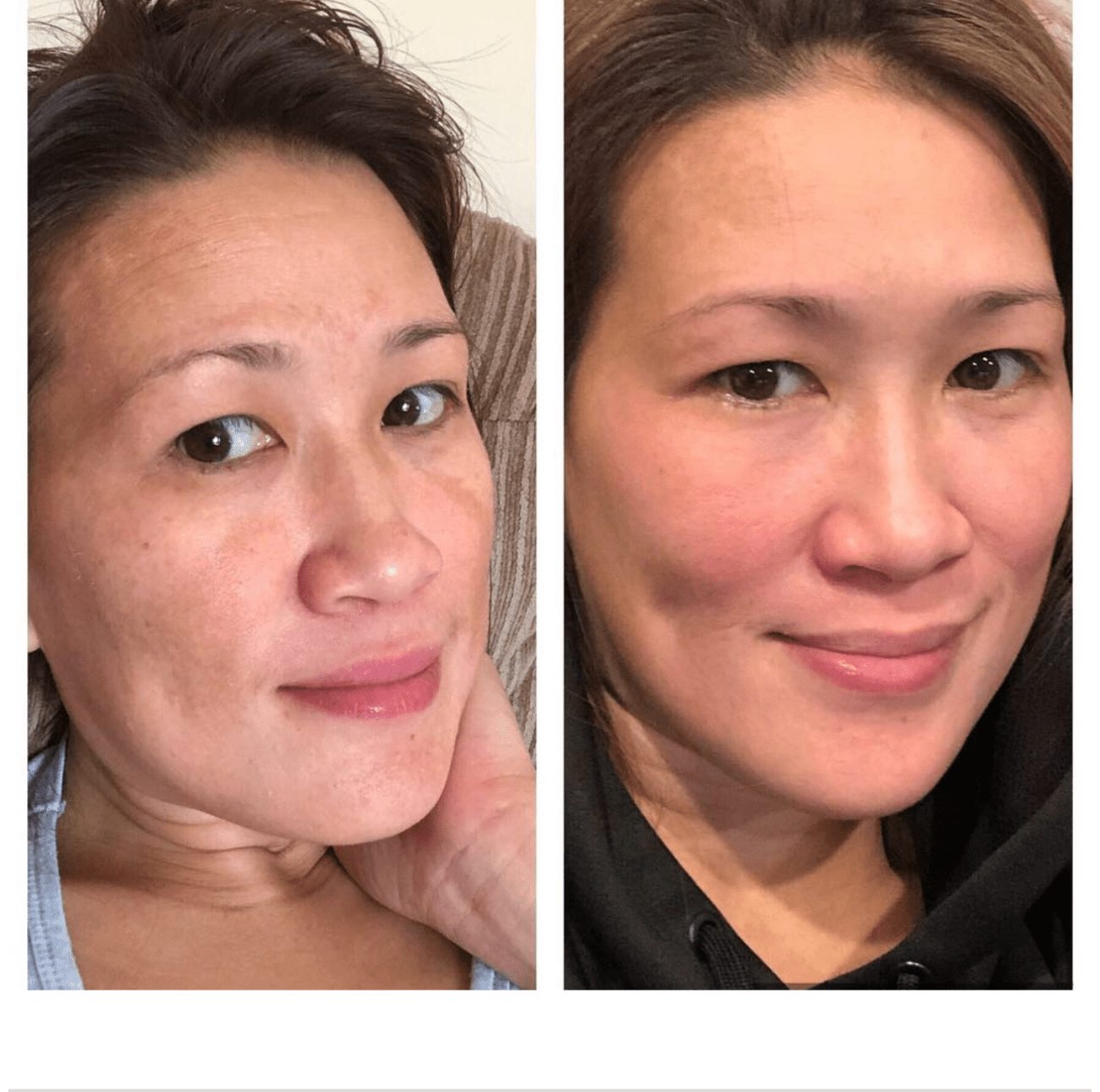 Premium Set (Good for 4 months)