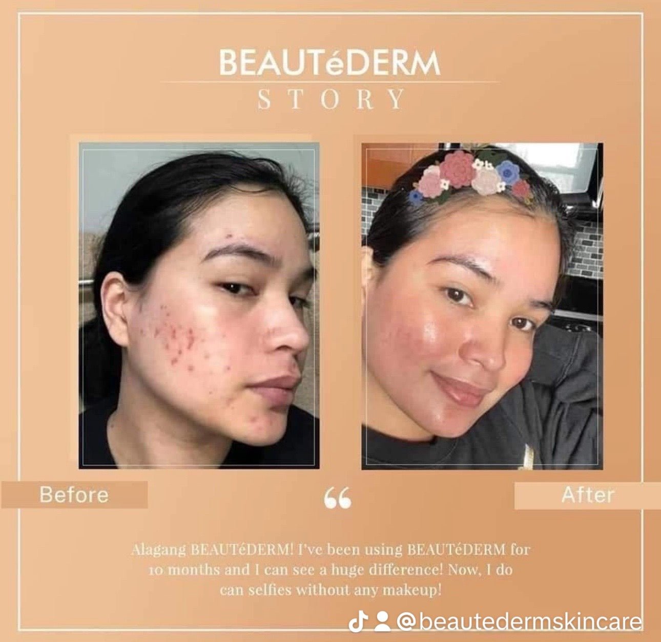 Premium Beautè Set (Big in Beauty)