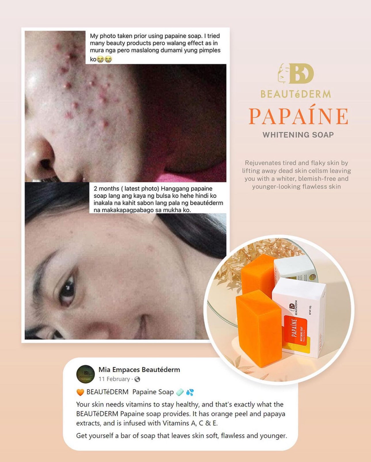 papaine whitening soap - happy customer’s review 