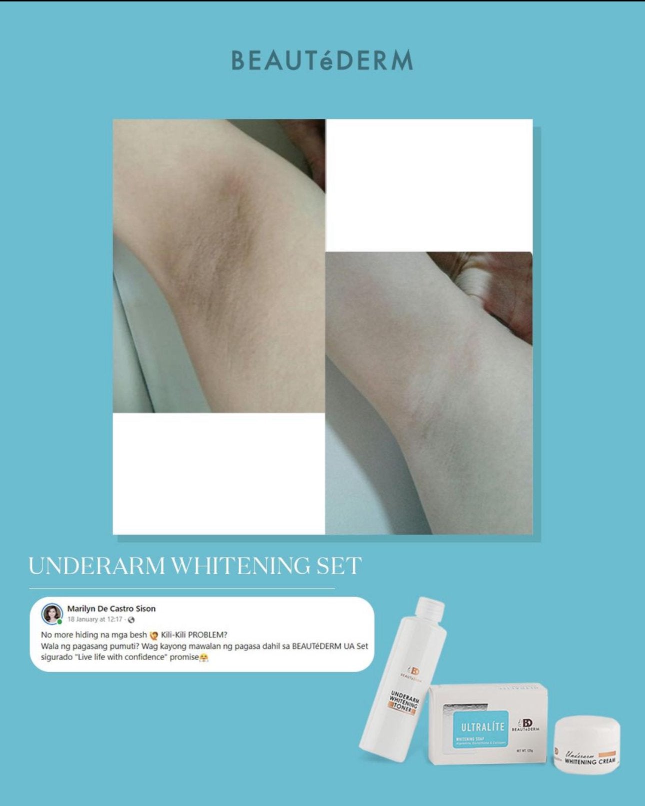 Underarm Whitening Toner (120ml) testimonial by beautederm - beautyderm 